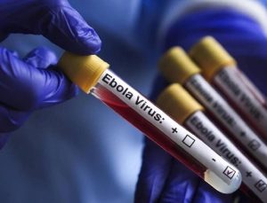 KKTC’den Ebola virüsüne karşı yeni tedbirler