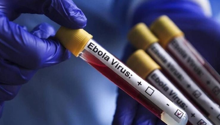 KKTC’den Ebola virüsüne karşı yeni tedbirler